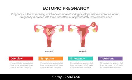 concept d'infographie sur les grossesses ectopiques ou enceintes pour la présentation de diapositives avec illustration vectorielle de liste en 3 points Banque D'Images