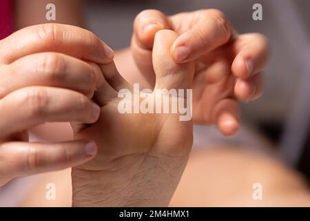 Gros plan des mains d'une infirmière inspectant le pied d'un patient avec le pied d'un athlète. Infection fongique entre les orteils qui provoque des démangeaisons, foul odo Banque D'Images