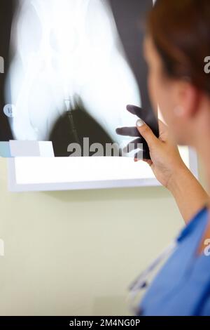 Pour bien faire, nous devons voir ce qui ne va pas. Une femme médecin regardant une radiographie. Banque D'Images
