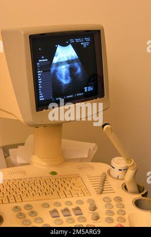 Échographie sur l'utérus d'une femme enceinte montrant un fœtus en bonne santé, échographie maternelle pendant la grossesse, suivi de la grossesse et santé du fœtus Banque D'Images