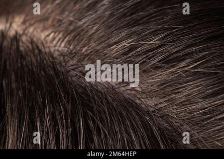 Super macro gros plan sur les cheveux et le cuir chevelu Banque D'Images