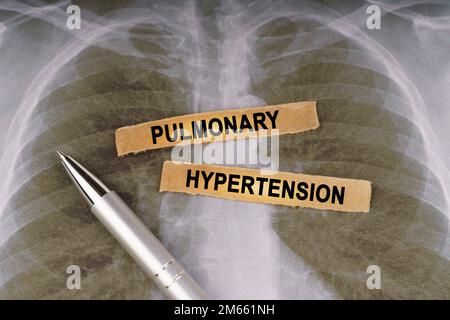 Concept médical. Sur une radiographie thoracique humaine, un stylo et des bandes de papier étiquetées - hypertension pulmonaire Banque D'Images