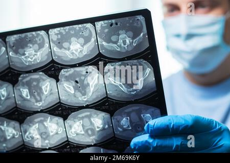 Homme médecin dans le masque examine l'IRM à l'hôpital. Banque D'Images