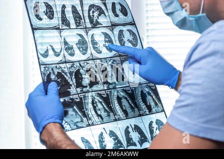 Homme médecin dans le masque examine l'IRM à l'hôpital. Banque D'Images