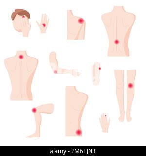 Parties du corps humain avec zones de douleur, illustration vectorielle isolée à plat Illustration de Vecteur