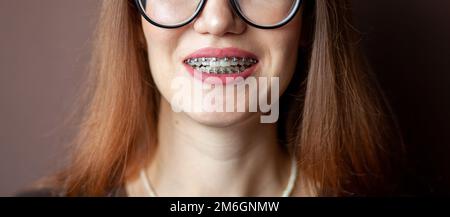 Le sourire d'une jeune et belle fille avec des bretelles sur ses dents blanches Banque D'Images