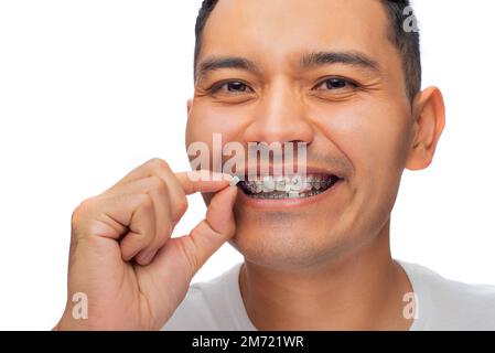 Visage d'un jeune Latino avec des sourires de peau sombre à la caméra, montre son traitement orthodontique, des bretelles en acier inoxydable plus des protecteurs de cire, un perso Banque D'Images