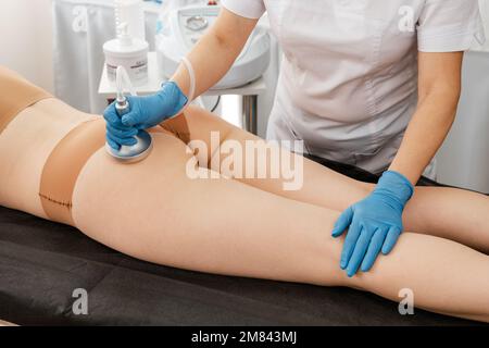 Procédé d'appareil de massage de drainage lymphatique. Massage sous vide. Banque D'Images