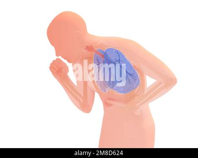 3d illustration de la toux de silhouette humaine croquant. Affichage des organes internes, mise en évidence du système respiratoire. Anatomie aux couleurs naturelles. Banque D'Images