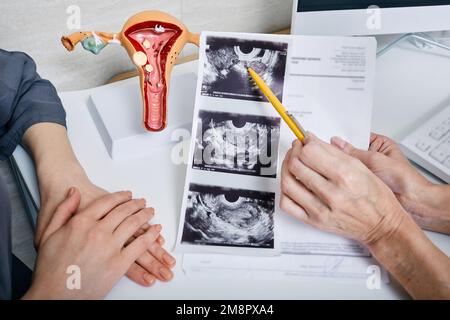 Gynécologie, santé des femmes. Gynécologue montrant à la femme l'échographie de ses ovaires pendant la visite à la gynécologie Banque D'Images