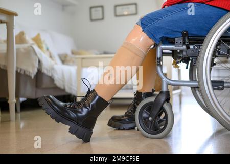 Gros plan des jambes orthopédiques d'une femme assise en fauteuil roulant. Banque D'Images