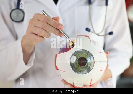 Médecin ophtalmologiste tenant le modèle anatomique de l'œil humain et pointant à l'aide d'un stylo. Banque D'Images