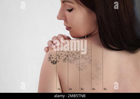 Retrait des tatouages au laser sur l'épaule de la femme. Traitement médical Banque D'Images