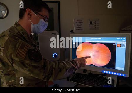 Le capitaine Dominic Rentz, optométriste du 15th Operational Medical Readiness Squadron, examine une photo d'une rétine à la clinique d'optométrie de la joint base Pearl Harbor-Hickam, Hawaii, 16 juin 2022. L'utilisation de caméras rétiniennes permet de diagnostiquer et de documenter les maladies oculaires et les changements dans la rétine au fil du temps. Banque D'Images