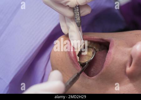 photo en gros plan du dentiste dans les gants pour vérifier la santé des dents de la patiente avec miroir dentaire dans le bureau de la dentisterie Banque D'Images