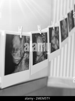 Collage de photos en noir et blanc Histoire d'images échographiques de bébé. Famille, accouchement, concept de la nouvelle vie Banque D'Images