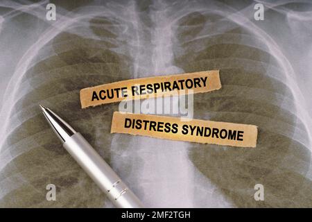 Concept médical. Sur une radiographie thoracique humaine, un stylo et des bandes de papier étiquetés - syndrome de détresse respiratoire aiguë Banque D'Images