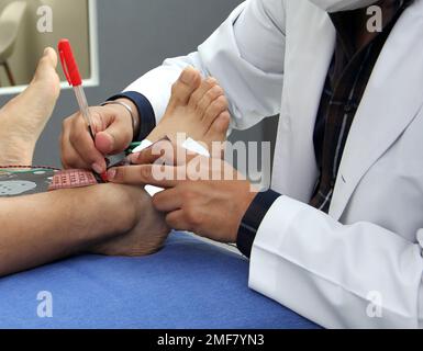 Les potentiels évoqués somatosensoriels (SEP) ou la vitesse de conduction nerveuse (NCV) est un test des signaux électriques à travers un nerf, réalisé conjointement Banque D'Images