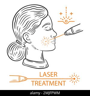 Traitement laser de peau de visage, femme anti-âge procédure de beauté, enlèvement de cheveux de visage, icône de rayon lumineux. Nettoyage médical, thérapie de rajeunissement. Vecteur Illustration de Vecteur