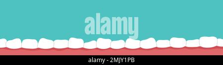 Banderole à dents tordues. Problème de malocclusion, plaque sur les dents. Concept de santé dentaire. Illustration isolée à vecteur plat Illustration de Vecteur