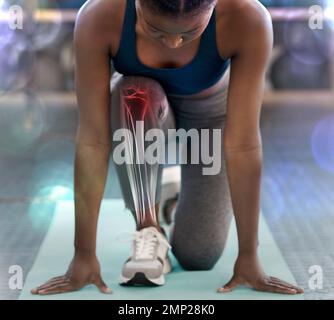 Femme noire, jambe et rayons X dans l'exercice de forme physique, d'entraînement ou d'entraînement sur tapis à la salle de gym. Coureur afro-américain sportif avec mal de genou ou blessé Banque D'Images