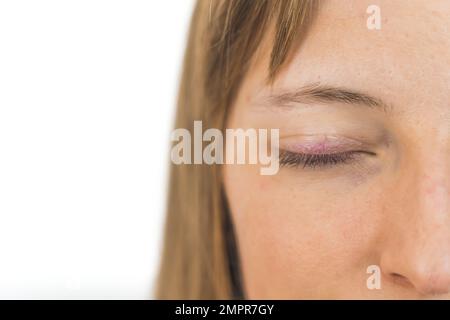 Gros plan sur la moitié du visage de la femme caucasienne avec un œil fermé sur fond blanc. Photo de haute qualité Banque D'Images