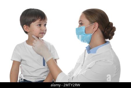 Médecin examinant un petit garçon avec la varicelle sur fond blanc. Virus varicelle-zona Banque D'Images