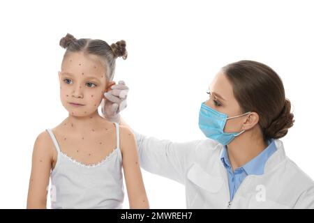 Médecin examinant la petite fille avec la varicelle sur fond blanc. Virus varicelle-zona Banque D'Images