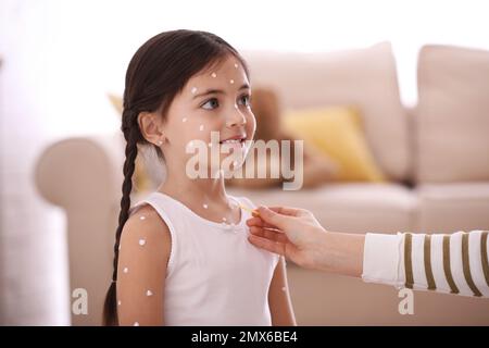 Mère appliquant de la crème sur la peau de sa fille avec la varicelle à la maison Banque D'Images