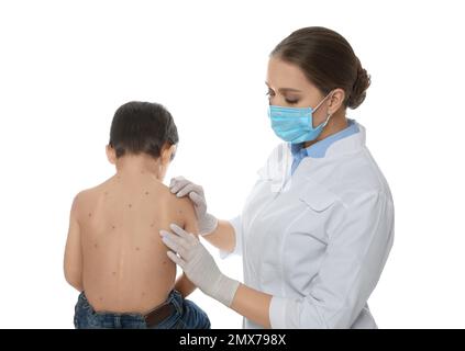 Médecin examinant un petit garçon avec la varicelle sur fond blanc. Virus varicelle-zona Banque D'Images