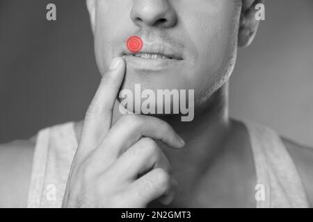 Homme avec l'herpès touchant les lèvres sur fond gris, gros plan. Effet noir et blanc Banque D'Images