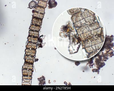 Zooplancton aquatique d'eau douce et algues sous microscope Banque D'Images