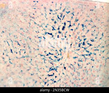 Les cellules de Kupffer sont des macrophages du foie. Le fer colloïdal agit comme une coloration vitale qui peut être introduite dans le corps étant phagocyté par les cellules Kupffer, Banque D'Images