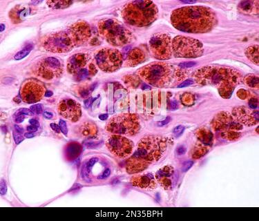 Macrophages fortement marqués avec du fer colloïdal. Le fer colloïdal peut être utilisé comme coloration vitale pour marquer les macrophages. Le fer colloïdal circulant est phago Banque D'Images