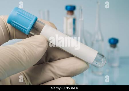 Tube à essai avec étiquette vide sur échantillon biologique pour la recherche en laboratoire médical sur fond bleu. liquide transparent dans un tube en verre dans la main de Banque D'Images