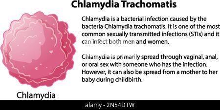 Chlamydia trachomatis avec illustration explicative Illustration de Vecteur