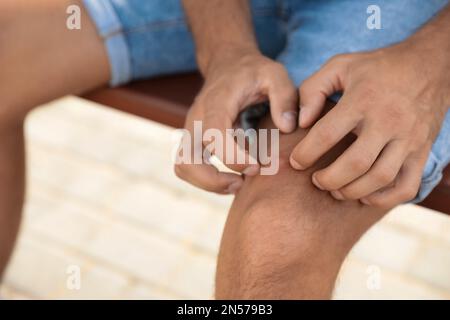 Homme rayant la jambe avec des piqûres d'insectes sur le banc à l'extérieur, gros plan Banque D'Images