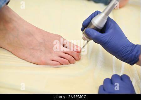 la podologue est une femme utilisant un laser pour traiter l'onychomycose - une maladie fongique des ongles. Cosmétologie matérielle Banque D'Images