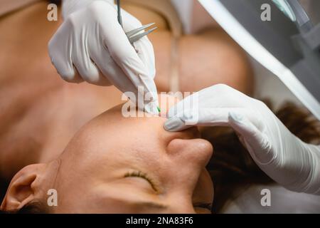 Esthéticienne en gants travail sur le visage de la femme client avec la seringue gros plan, électrolyse visage enlèvement de cheveux, procédures de beauté Banque D'Images