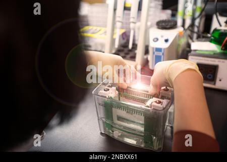 Analyse Western blot utilisation comme analyse de protéines pour la détection de protéines. Cette technique est utilisée en laboratoire médical ou de recherche. De plus, la méthode détecte le VIH Banque D'Images