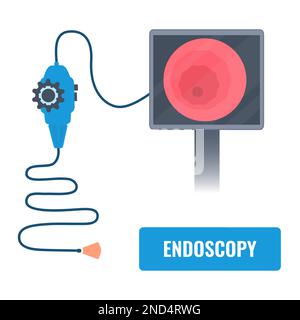 Procédure de gastroscopie de l'examen de l'estomac avec endoscope Illustration de Vecteur