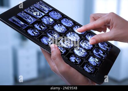 Médecin examinant des images radiographiques sur une tablette à l'intérieur, gros plan Banque D'Images