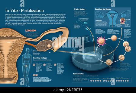 Infographie du processus de fécondation in vitro, de ce qu'il est et de la probabilité de réussite associée. [QuarkXPress (.qxp); 6259x4015]. Banque D'Images