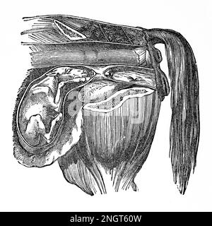 Prochaine naissance d'un foal. Illustration antique d'un livre médical. 1889. Banque D'Images