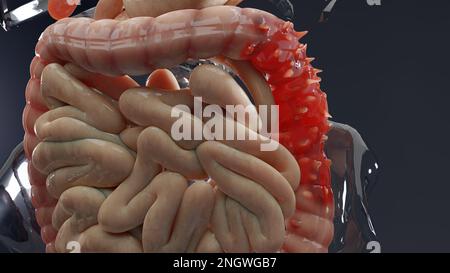 Anatomie du système digestif humain, concept de l'intestin, diverticulite, rendu 3D Banque D'Images