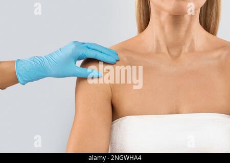 Médecin main vérifiant mole nevus sur l'épaule de la femme méconnaissable Banque D'Images