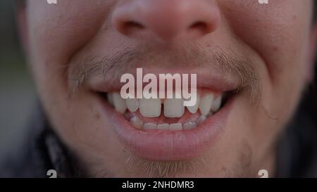Très gros plan sourire d'un jeune homme charmant avec un sourire crasseux Banque D'Images