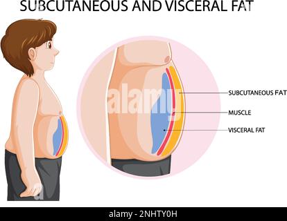 Illustration du schéma de la graisse sous-cutanée et viscérale Illustration de Vecteur