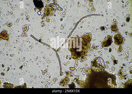 micro-organismes du sol dans un échantillon de sol, champignon du sol et bactérie dans une ferme régénératrice en compost. les champignons hyphes dans un essai de sol. en australie Banque D'Images