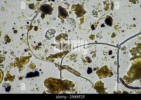 micro-organismes du sol dans un échantillon de sol, champignon du sol et bactérie dans une ferme régénératrice en compost. les champignons hyphes dans un essai de sol. en australie Banque D'Images